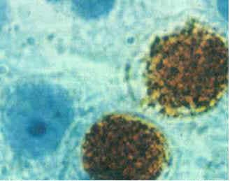 Возбудитель орнитоза под микроскопом Возбудитель орнитоза под микроскопом